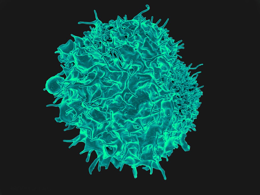 Colourised scanning electron micrograph of a T cell (Image by NIAID, CC BY 2.0, via Wikimedia Commons)