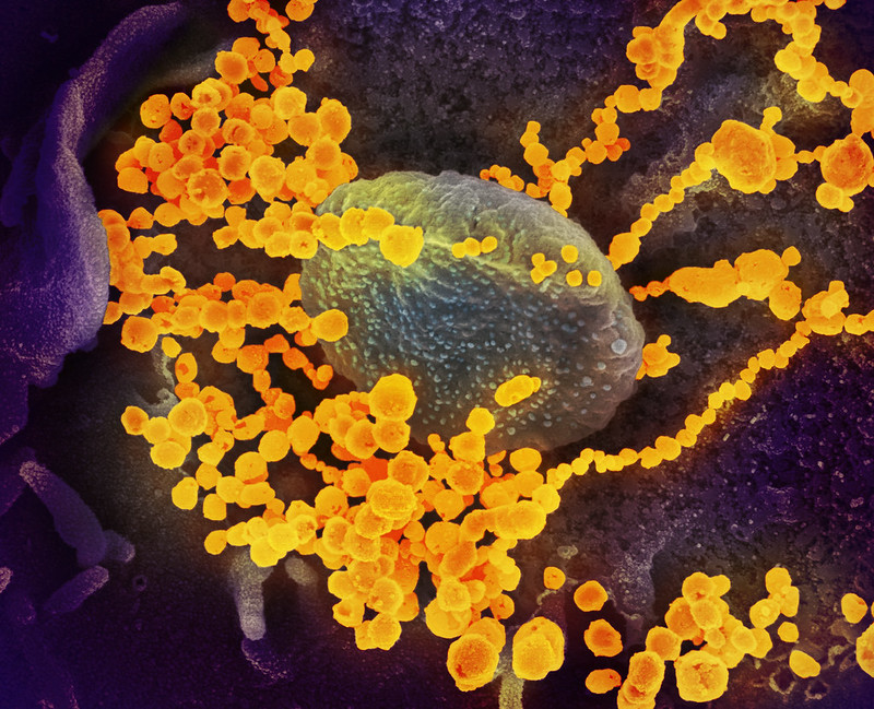 This scanning electron microscope image shows SARS-CoV-2 (round gold objects) emerging from the surface of cells cultured in the lab. SARS-CoV-2, also known as 2019-nCoV, is the virus that causes COVID-19. The virus shown was isolated from a patient in the U.S. (Credit: NIAID-RML)