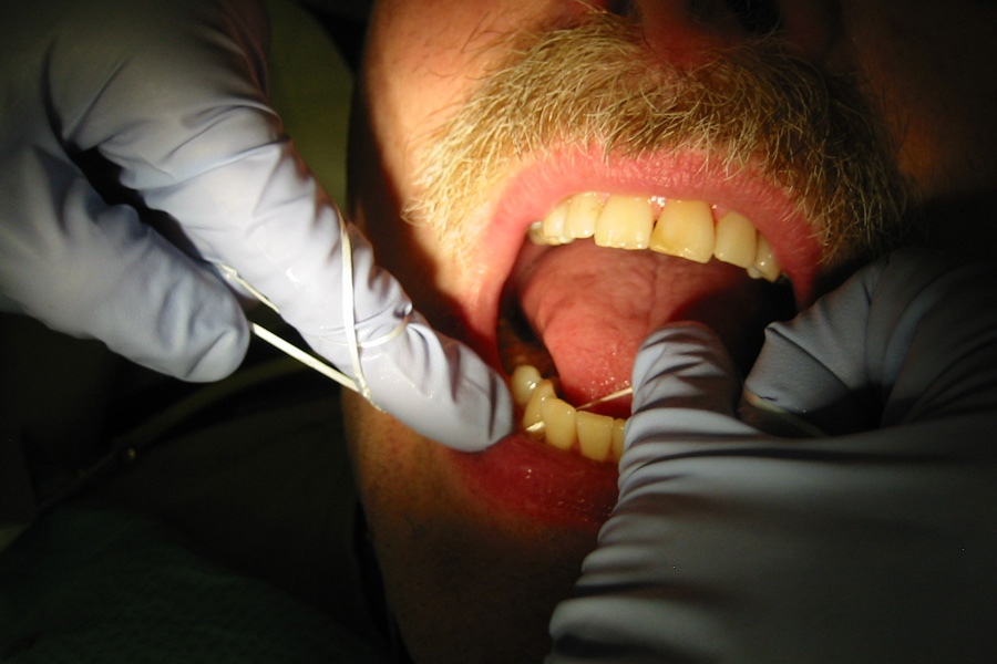 Flossing foto by Walter Siegmund, via Wikimedia Commons