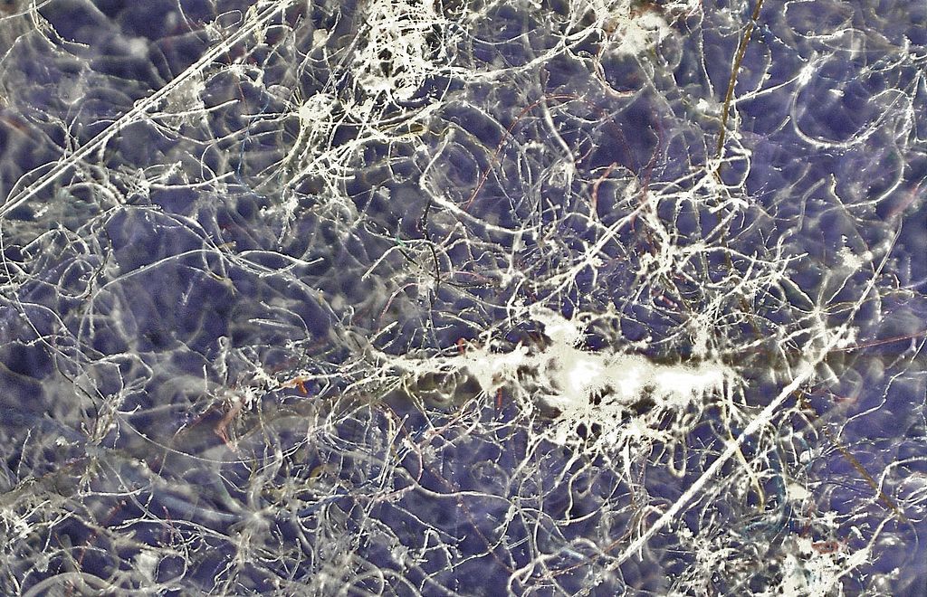 House dust under a microscope (image by Lamiot, via Wikimedia Commons)