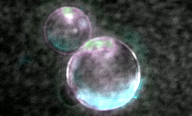 Super-resolution image of SpudCell liposomes (Photo by Orion Venero/Adamala Lab)