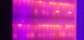 PCR electrophoresis gel