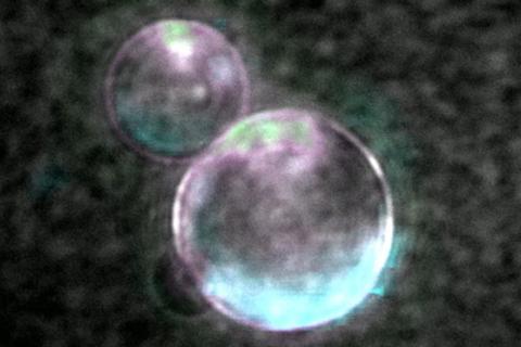 Super-resolution image of SpudCell liposomes (Photo by Orion Venero/Adamala Lab)