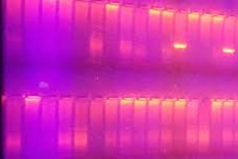 PCR electrophoresis gel