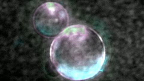 Super-resolution image of SpudCell liposomes (Photo by Orion Venero/Adamala Lab)